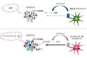 山梨大など、神経変性疾患「アレキサンダー病」の病態に関わる細胞を発見