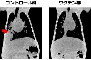 大阪公大、幅広い血清型をカバーできる新奇の肺炎球菌ワクチンを開発