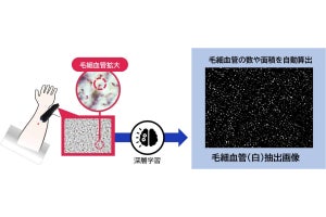 花王、広視野で皮膚毛細血管の数や面積を定量化する新技術を開発