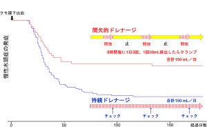 くも膜下出血後の脳脊髄液ドレナージは間欠的な方が有効の可能性、名古屋市立大が報告