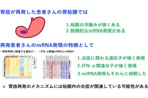 胃がん時にピロリ菌を除去しても再発が起こる仕組み、千葉大が一端を解明