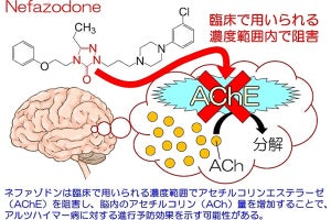 既存の抗うつ薬がアルツハイマー病にも有効な可能性 - 東邦大が発表