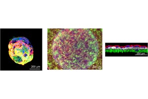 東京医科歯科大などが胎盤オルガノイドを開発、副作用の少ない胎児向け新薬開発などに期待