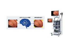 オリンパスのAI搭載内視鏡画像診断支援プログラム、2024年6月より診療報酬の加算対象に