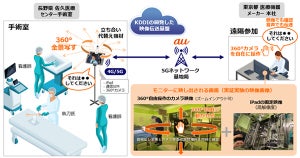 KDDI、映像伝送基盤と360度カメラを活用した手術のオンライン立ち合い実証