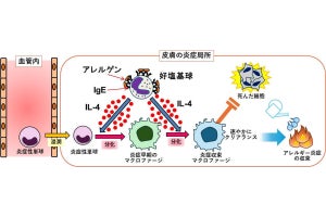 皮膚アレルギーを炎症性単球が変化し抑制する、東京医科歯科大が発見