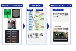 NEC×TMDU、スマホ映像や問診データで慢性腰痛のセルフケアを支援するAI技術を開発