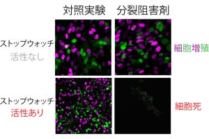 OIST、細胞分裂時に異常が生じたことを細胞自身が検出する仕組みを解明