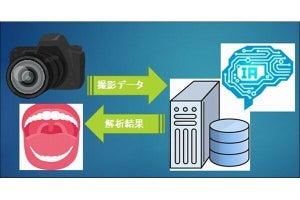 電通総研×東大医学部附属病院、AI活用で口腔癌の画像診断支援システムを共同開発