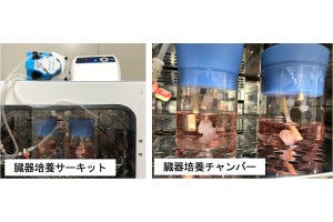 東北大、従来の1/10のコストで済むマウス肺とヒト細胞の臓器移植実験に成功