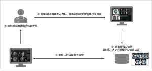 富士フイルムら、肺がん化学放射線療法の過去症例を検索できるシステムを開発