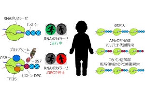 名大、飲酒による二日酔いの原因物質が遺伝子を傷つけ老化を引き起こすと発表