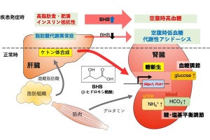 千葉大、腎臓による糖新生の制御には「ケトン体」が重要であることを確認