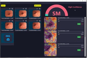 岡山大と両備システムズが開発した胃がんAI診断支援システム、医療機器製造販売承認を取得