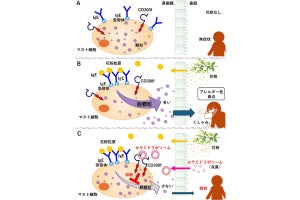 順天堂大、花粉症などのアレルギー性鼻炎を抑制できる生体成分を発見