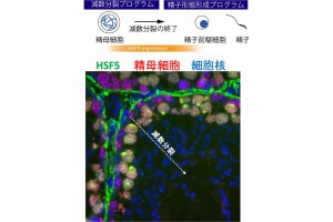 熊本大、雄性不妊に関わる精子形成の減数分裂の終結を制御する遺伝子を発見