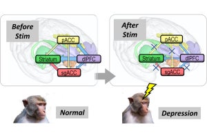 京大、脳で理性が感情を制御しているメカニズムを解明