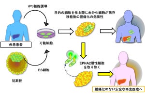 NAIST、iPS細胞などの移植後腫瘍化の発生確率を抑制する技術を開発