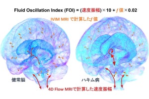 名市大、頭蓋内全体の脳脊髄液の動態をマクロ的に観測する手法の開発に成功