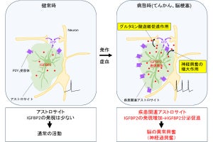 脳の異常興奮を引き起こすグリア物質「IGFBP2」、山梨大などが発見