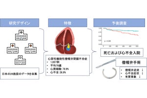 順天堂大、高齢者に多い「心房性機能性僧帽弁逆流症」の実態を解明