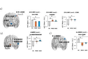 千葉大、うつ病と社交不安症に関わる脳機能の異常を解明