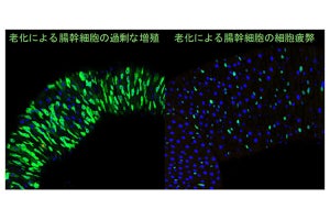 理研、老化すると組織幹細胞も疲弊することをハエから発見