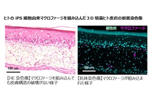 キリン、免疫細胞のマクロファージを組み込んだ3D培養ヒト皮膚モデルを開発