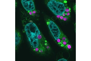 東大など、光合成活性を持った葉緑体の動物の細胞への移植に成功