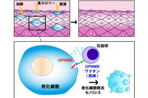 近未来テクノロジー見聞録 第166回 アルツハイマー治療に期待 - 順天堂大学、老化細胞除去ワクチンの開発に成功