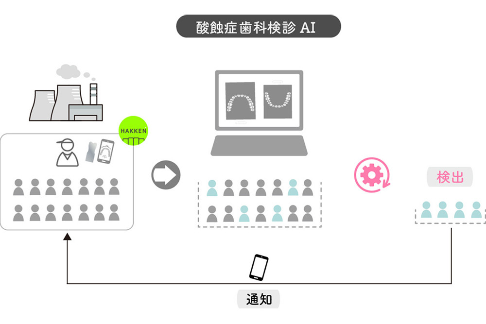 近未来テクノロジー見聞録 第211回 スクリエが開発し基本特許を取得した酸蝕症の歯科健診AIとは？